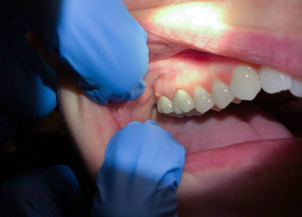 Best Emergency Treatment for Toothache in Huntersville, NC