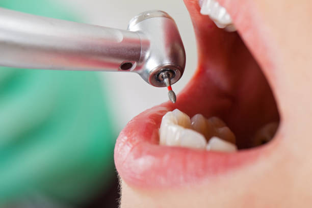 Best Emergency Dental Surgery in Huntersville, NC